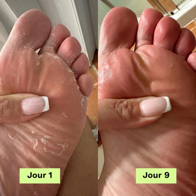 Skina® Pieds Nets