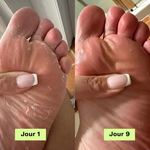 Skina® Pieds Nets