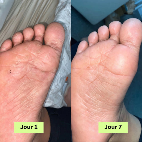 Skina® Pieds Nets