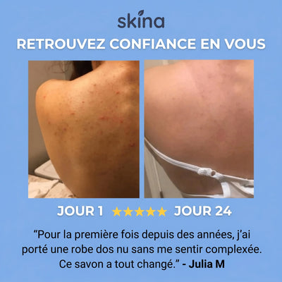 Skina® Dos Net