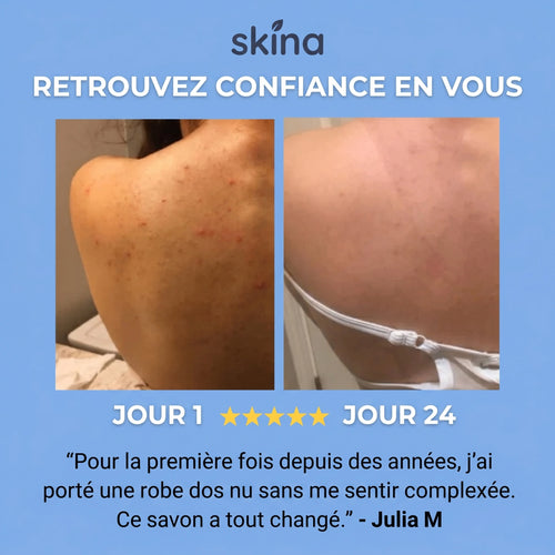 Skina® Dos Net