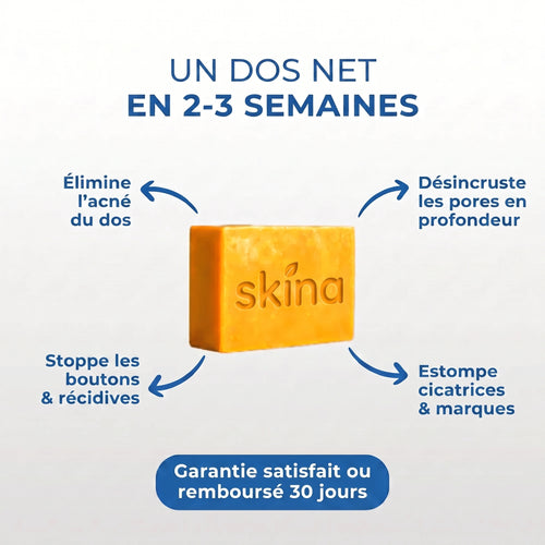 Skina® Dos Net